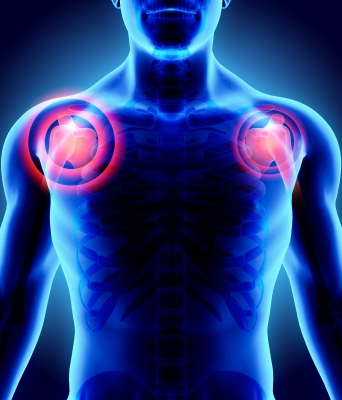 Polymyalgia Rheumatica | West Hills, CA | Dr. Nazanin Firooz