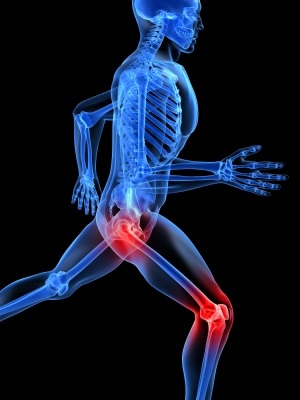 Osteoarthritis in West Hills, CA