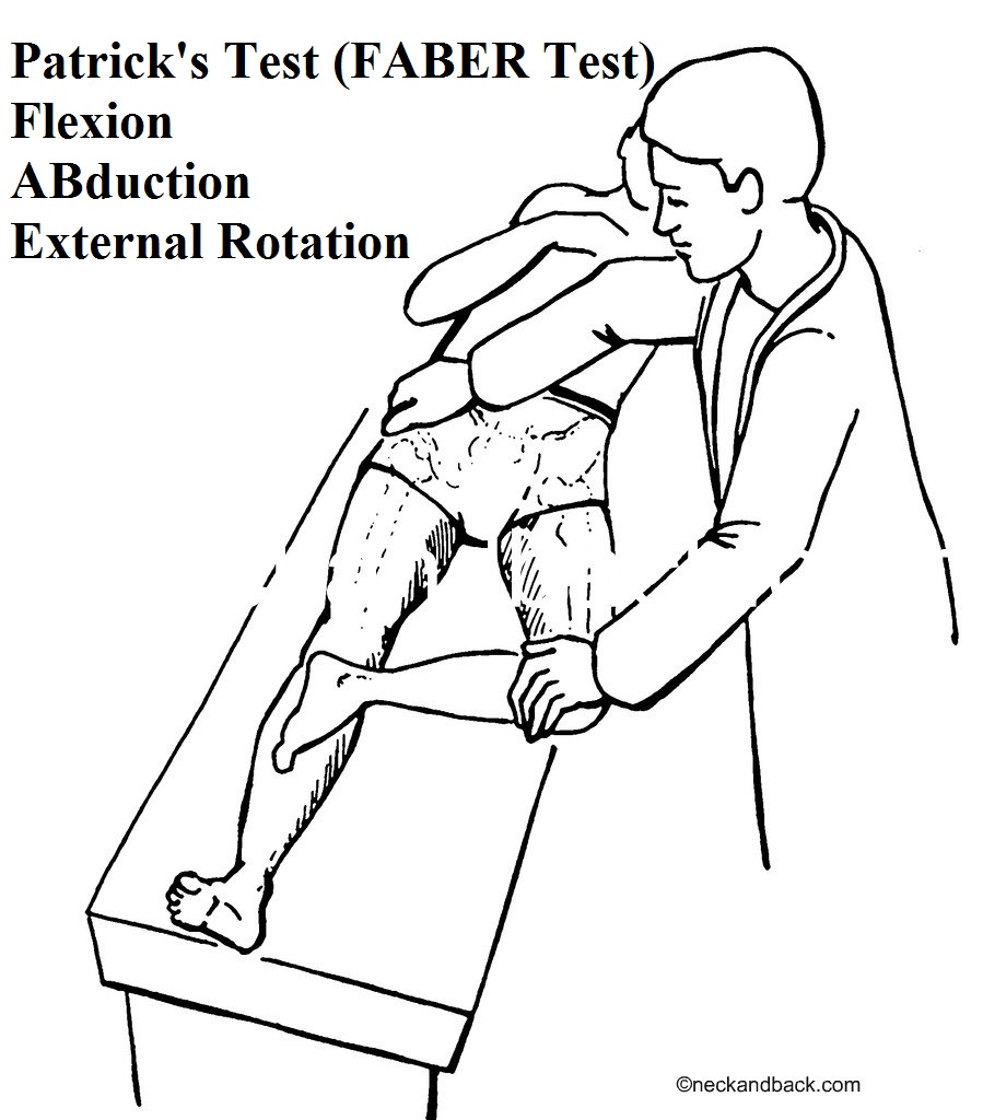 Diagnosis and Treatment of Ankylosing Spondylitis in West Hills, CA