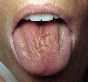 Sjögren’s syndrome in West Hills, CA