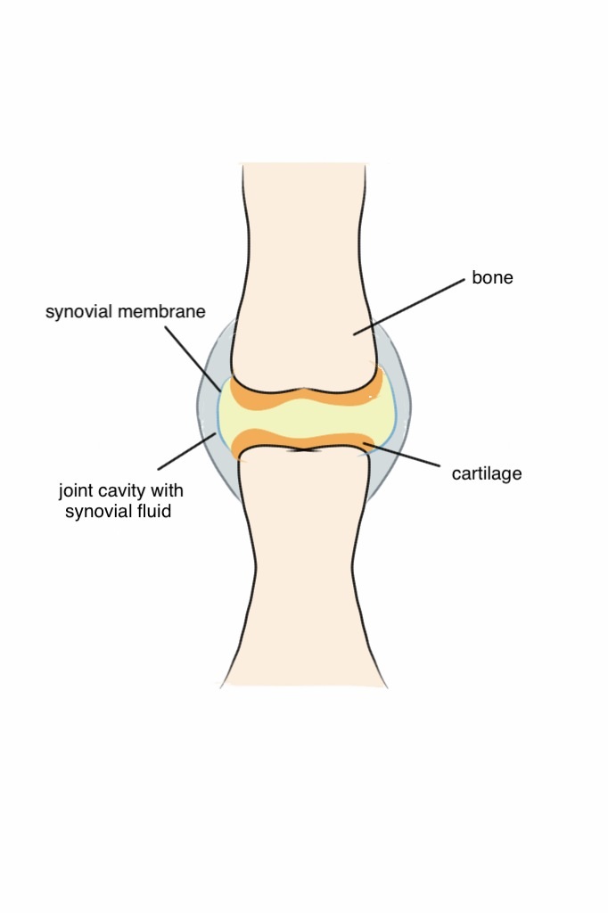 Osteoarthritis in West Hills, CA